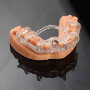 Máng cấy ghép implant