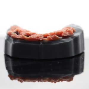 Mẫu hàm/mẫu xương in 3D